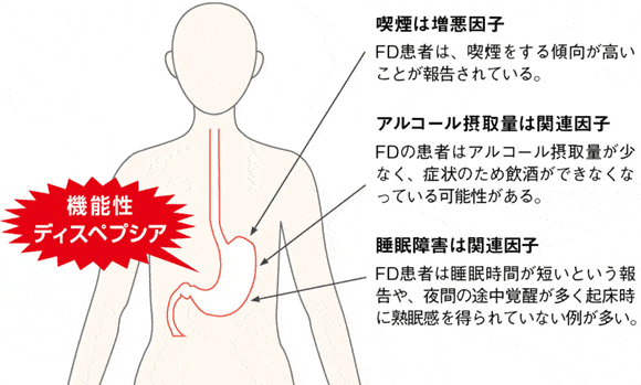機能性ディスペプシア(FD)症状に関係する生活習慣