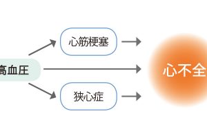 心不全は主に心筋梗塞や狭心症など、心臓のさまざまな疾患が原因で、最終的に至る症候群を意味する。また、高血圧で長年心臓に負担がかかっている場合にも心臓の働きが落ち、心不全の原因になることもある。