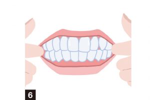 6. 人差し指を口角から頬の内側に引っ掛けて、口が「イー」の形になるように引っ張る。