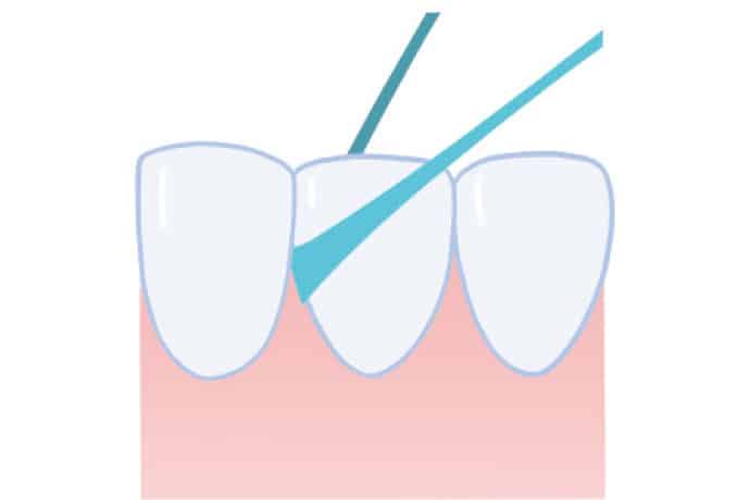 【歯間ケアとメンテナンス編】不調を呼ぶ口中老化を防ぐには、正しい歯みがき習慣が基本です。