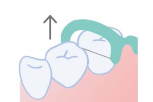 3. 歯と歯肉の境目まできたら、歯の側面の汚れを掻き出すように上に動かす。