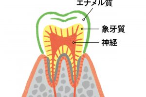 歯の酸蝕が進行して象牙質まで溶け出し、神経に響く段階でやっと気づく。