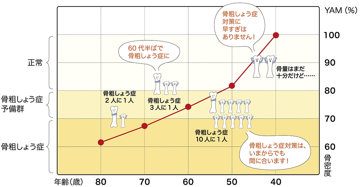 「骨密度の減少」が気になる人のための３つの記事。