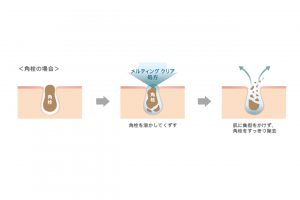 指どまりのよいテクスチャーをなじませて、角栓を溶かしてくずす処方。肌に負担をかけずに角栓を溶かし、すっきり落とす。