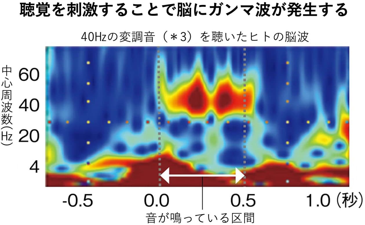 最新研究！ 〝聴くこと〟で脳を刺激して、認知機能をキープする。 | くらし | クロワッサン オンライン