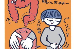 S状結腸もみで腸のぜん動運動を促す。