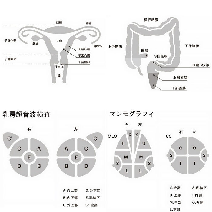 発症しやすい病気の兆候に気づくために、人間ドックで注意したい6つの項目