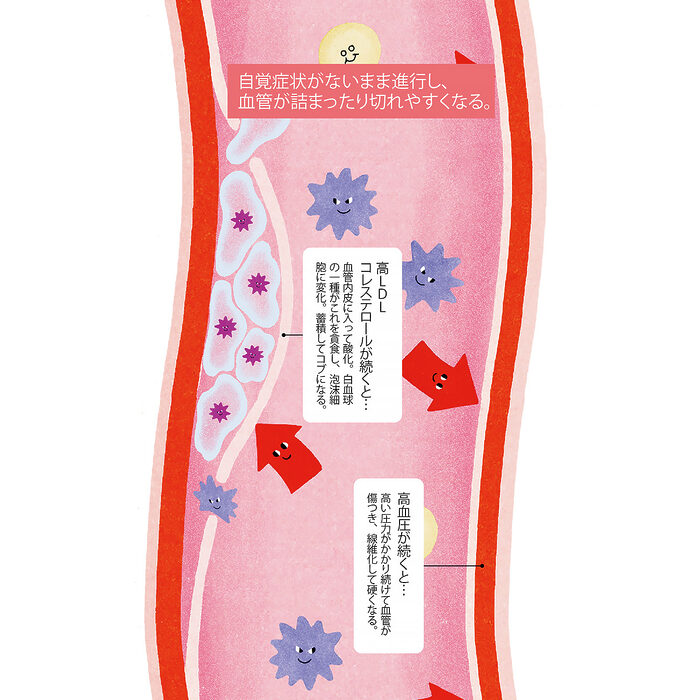 原因を知って数値をコントロール。コレステロール、血圧、血糖値はなぜ上がる？