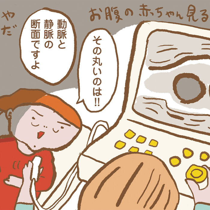 【あなたの血管は大丈夫？】病気になってからでは遅いから、“血管年齢”検査を初体験！