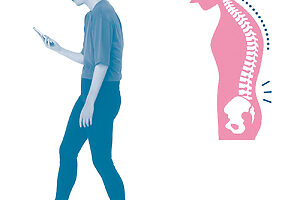 重心が後ろ寄りの猫背タイプ。重い頭を支える首まわりの筋肉が張り、体幹をかがめてバランスを取っているので腰にも負担がかかる