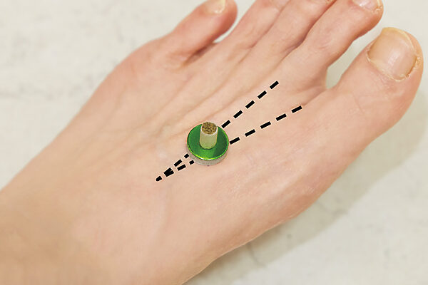 「お灸」で局所を温めればなぜコリに効く？ そのメカニズムを知ろう