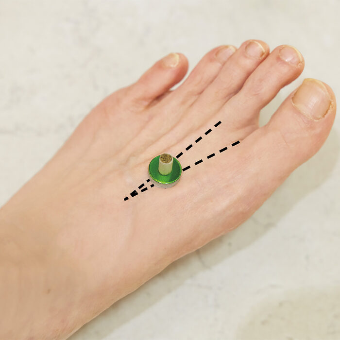 「お灸」で局所を温めればなぜコリに効く？ そのメカニズムを知ろう