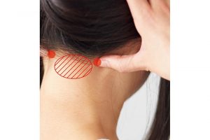 4.ぼんのくぼ（斜線部）左右の太い筋肉の外側にある「天柱」。頭の血行を促すポイントのツボ。ついでにぼんのくぼも押すとよい。