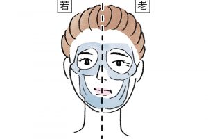 【骨】骨は老化すると骨自体がやせ、もろくなる。全体的に下に落ち、前にずれる傾向が。特に眼窩が大きくなり、頰骨が低くなるので、その上の筋肉や脂肪、皮膚がたるむのは当然。